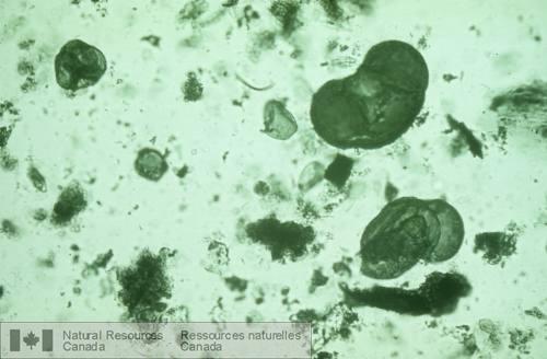 Photo 2000-027 : Photographie au microscope de grains de pollen fossiles provenant dun lac à proximité de Yellowknife